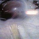 서울성모안과병원 이미지