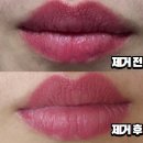 미작미용실 | 강남 신사역 입술 문신 제거를 원하면 미작뷰티 강남 본점