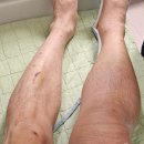 본브릿지정형외과의원 티스토리