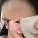 이공구에스티 | [공지] [두리뷰티] 옥시티컬 공구 (2026년 첫 공구 신년이벤트)