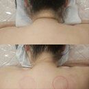 💆‍♀️동탄신부관리 받으러 장지동 ‘올뷰티유’ 방문 후기