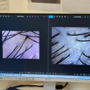 밥친구 | 미사역두피관리 두피밥 남자친구 탈모관리 솔직 후기