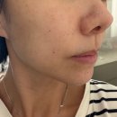 청담셀의원 | 청담줄기세포 바우스의원에서 셀빅스받고 젤리피부 소리들었어요