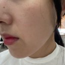 예뻐진데이 | 인셀덤 인천본점 피부체험 예뻐진데이 초대후기