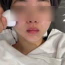 송내메가타운 앞(갤러리) | 동두천피부관리 더영뷰티에서 홍조관리 받은 후기