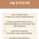 [스마일라식] ㅇㅅㅇㅇ안과 수술 후기 (내돈내산)