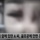 캐디 앞에 두고 ‘풀스윙’…얼굴 피범벅 만들고도 18홀 강행 이미지