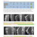 어린 고양이의 traumatic physeal fracture 이미지