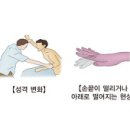 간성 뇌병증 (Hepatic Encephalopathy) 이미지