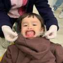 거창미르치과의원 | 교정 일대기 (실시간 수정) / 대구 미르치과 &amp; 올바른치과 비교 / 미르치과 교정 후기