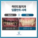 오송미소치과의원 | 오송역치과 온 가족이 안심하고 다닐 수 있는 따뜻한 주치의