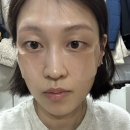 썬파트너스 - 성남시 중원구 | ☀️ "나 오늘 뭐 붙였게?" 기미 지키는 스텔스 투명 썬패치, 프란츠 솔직 후기