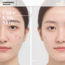 건강한 피부샵 | 강남역 문제성 피부 관리로 촉촉하고 건강한 피부 얻은후기