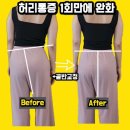 골반교정 필라테스 이미지