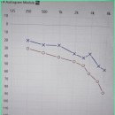 독일시그니아보청기 이미지
