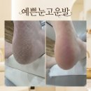 예쁜손고운발만들기 | 광주 패디플래닝 굳은살까지 싹 다 해결한 '예쁜눈고운발' 후기