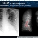 아이피메디칼 이미지