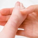 아이피부 이미지