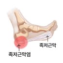 진접신발