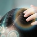 쉽고 빠른 생활 응급처치 가이드 | 두피 가려움, 즉시 멈추는 법! 원인별 피해야 할 행동과 응급처치 가이드