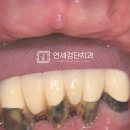 연세아라치과 이미지