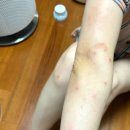 운산보건지소 이미지