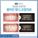 반치과 네이버블로그