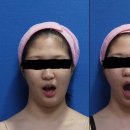 아름 한의원 | 아름턱 한의원 40회차 후기임 내 돈썼음