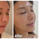 마린시티종합동물병원 | 해운대 에스테틱 추천 | AI심층피부진단 + 슈라멕케어 후기 마린시티 피부관리