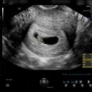 서현삼성산부인과의원 이미지