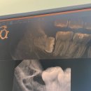 연세허치과의원 이미지