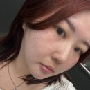 영통 메이퓨어 | 영통역 피부과 / 내돈내산 멜라듀스 시술 후기 / 더마샤인 기계 주사 / 주근깨 기미 치료 / 미백 기미...