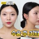 뉴진성형외과의원 네이버블로그