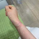 강종원정형외과의원 티스토리
