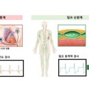 유방암 수술 후 퉁퉁 붓는 손발… ‘미리’ 알 순 없을까? 이미지