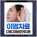 씨앤씨이비인후과 네이버블로그