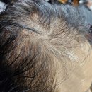 큐사랑부천상동 | 부천 두피관리 [큐사랑 부천지사] 방문 후기 편안했던 관리 이야기