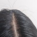 내몸에휴 이미지