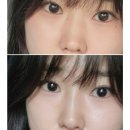 내돈내산레이디코후기/레이디코내돈내산/레이디코붓기/