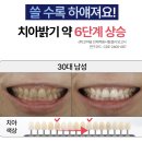 스마일라인치과기공소 | 치아 하얘지는 방법, 임상으로 검증된 치아미백, 프로벨 스마일밤으로 집에서 치과급 효과 누리기