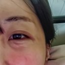 스킨부스터 홈케어 가이드 (1)｜샤넬주사·싸이토케어 직구 구입법 + 관세·통관 총정리