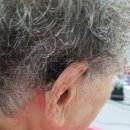 시그니아독일보청기도봉센터 이미지