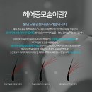 촘촘 스칼프 이미지