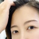 브로우원 이미지