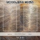 노원두피관리 후기부터 효과까지 꼼꼼하게 따져보셨어요???