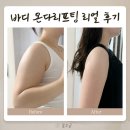 짬사우나 | 구월동 피부과 바디 온다리프팅 후기