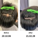 스칼프H 네이버블로그