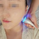 울산 남구 세라 에스테틱 물방울 리프팅 추천