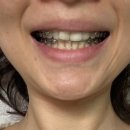 참좋은김치과의원 이미지