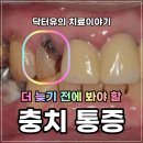 닥터유바른치과의원 | 보정동 충치 통증 언제부터 시작될까? 단계별 증상·치료